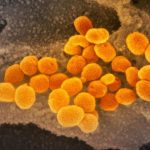 英国発のコロナ変異株、春に米国で感染急増の恐れ　専門家