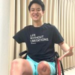 切断した手に「雷に打たれたような激痛も」　10年経っても消えぬ「幻肢痛」、当事者語る辛さ