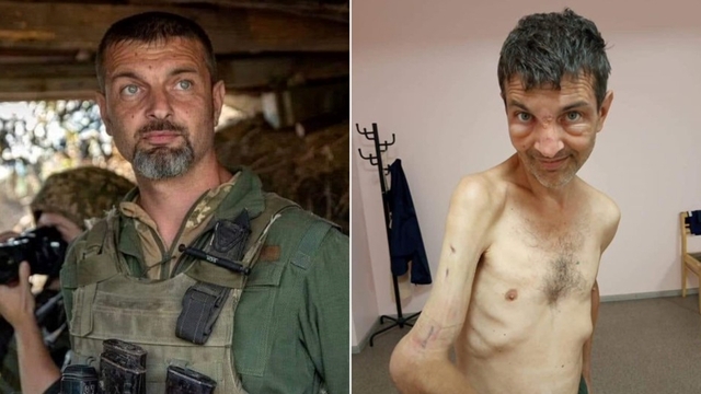 ウクライナ、ロシアの捕虜になる前と後の兵士の画像公開