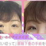 北斗晶、眼瞼下垂の手術を報告「もっと早くやっておけば良かったな～」経過も明かす