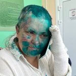 ロシア調査報道記者、暴行受け入院