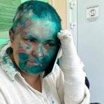ロシアの独立系ジャーナリストと弁護士、チェチェンで襲われる　過去に殺害予告