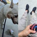 突進してきた首輪のない犬、珍島犬とその飼い主が噛まれ、血まみれ…「これは殺人未遂」
