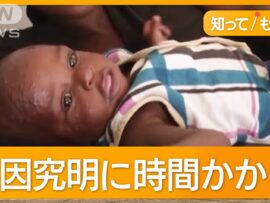 コンゴで謎の病気が流行、10代を中心に140人以上が死亡の危機