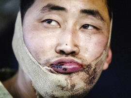 ウクライナで捕虜となった北朝鮮兵士、驚きの告白「ウクライナに住みたい」