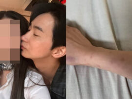 「暴行受けて性病うつされた」元交際女性の暴露…俳優チョン・ホジュン「殴られたのは僕のほう」