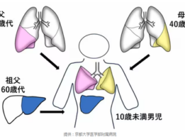 【日本の医療凄すぎた】生体肺肝同時移植手術に世界初実施で成功「父の右肺、母の左肺、祖父の肝臓を子供に同時移植」