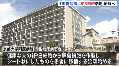 【iPS細胞】まじで凄すぎる、日本徐々に医療革命を起こし始めている模様「糖尿病治験開始、インスリン注射不要に期待」