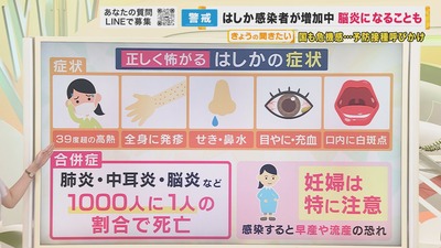 【悲報】ベトナムから帰国の愛知20代女性『はしか』に感染　JR中央線や市営地下、高速バスを利用した後に関西国際空港→伊・仏で発疹で判明